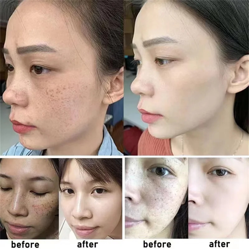 White Rice Whitening Cream Remove Dark Spots Fade Freckle Melanin Repair Product gallery