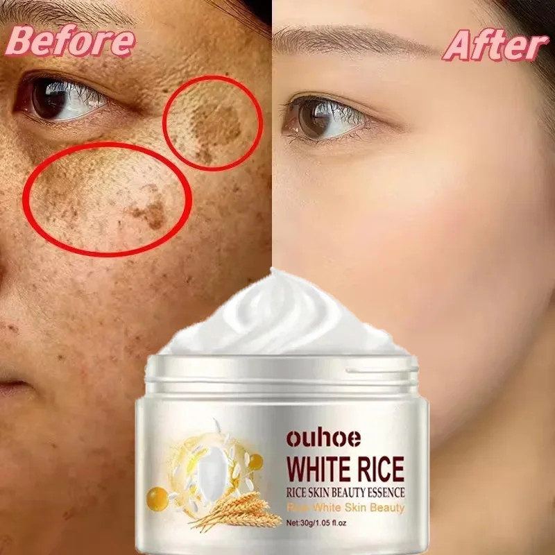 White Rice Whitening Cream Remove Dark Spots Fade Freckle Melanin Repair Product